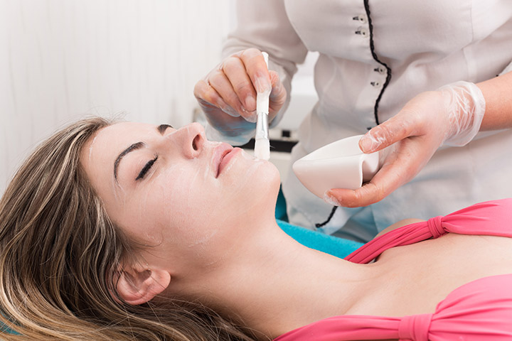 chemical-peel