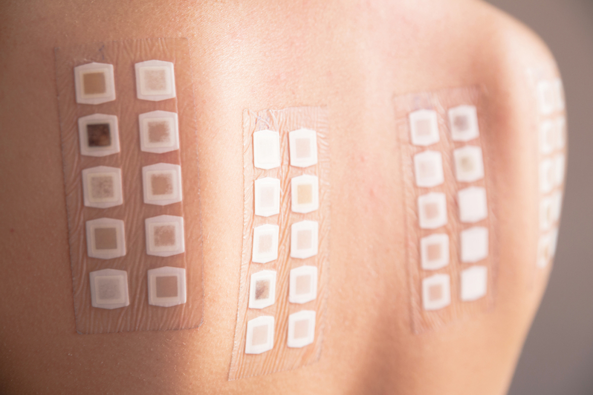 Types of Allergy Tests