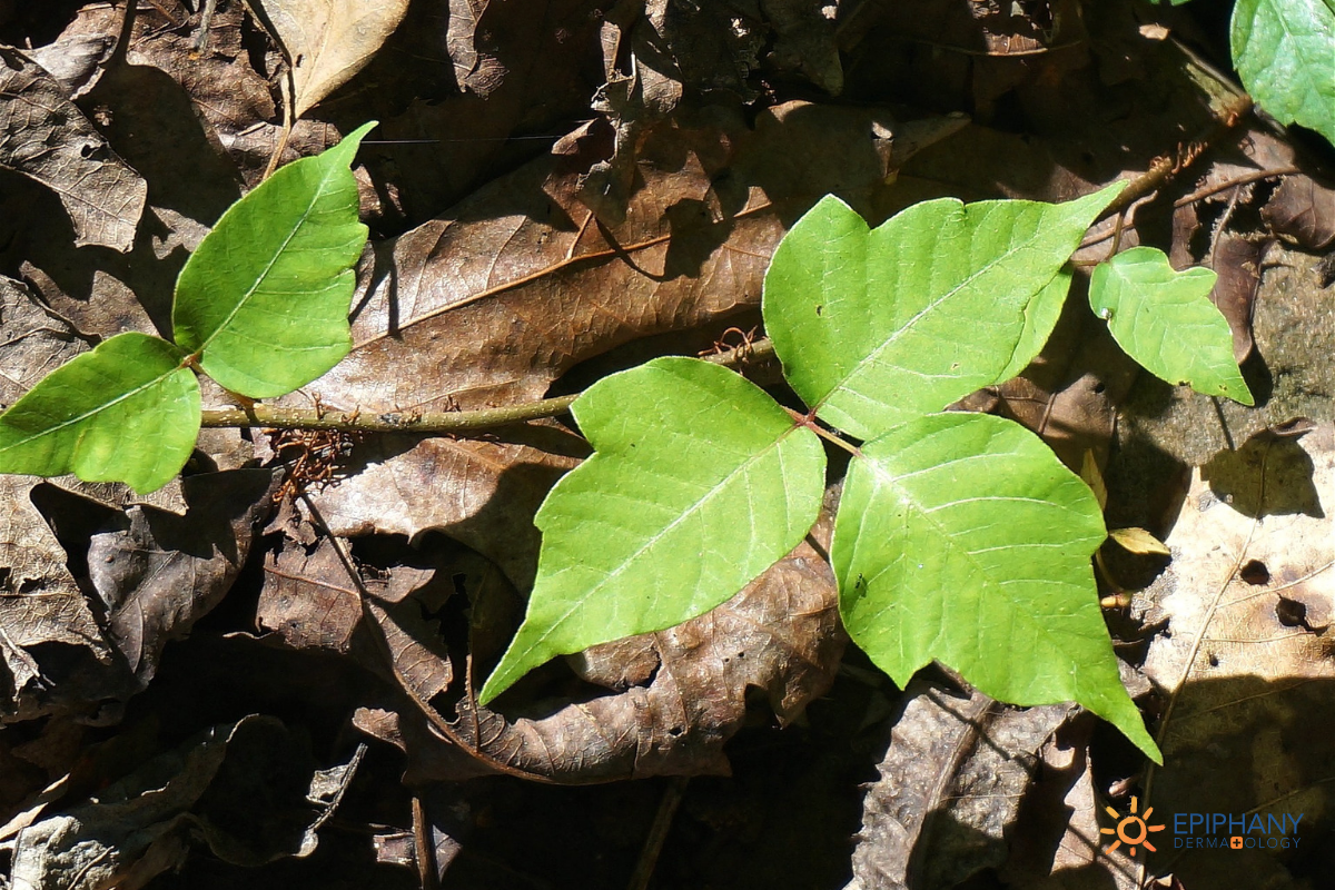 poison ivy