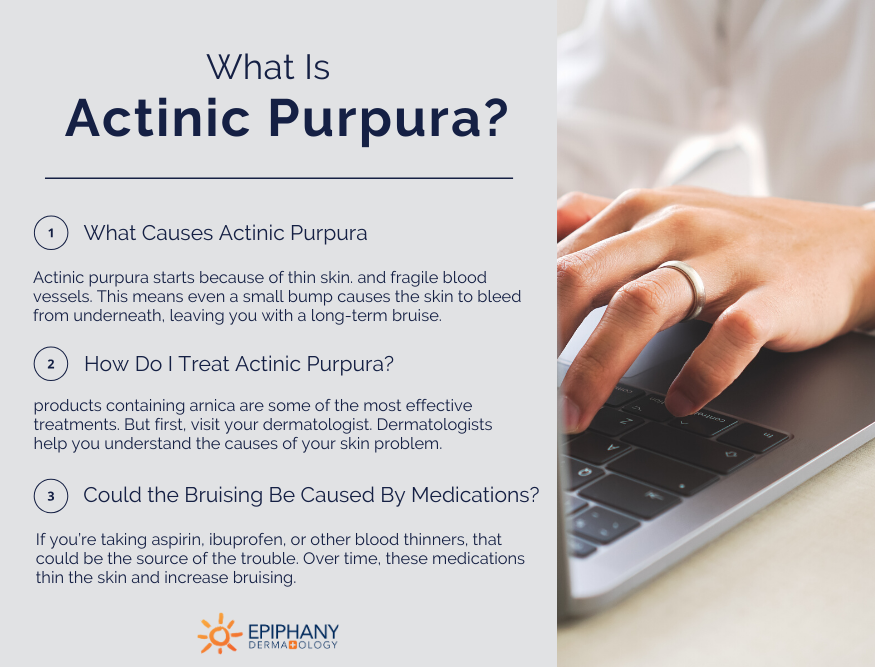 what is actinic purpura