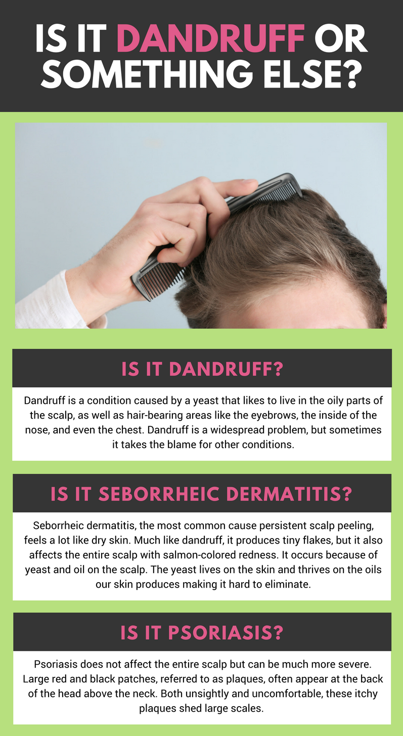 Itchy, Flaky Scalp? It May Be More than Just Dandruff