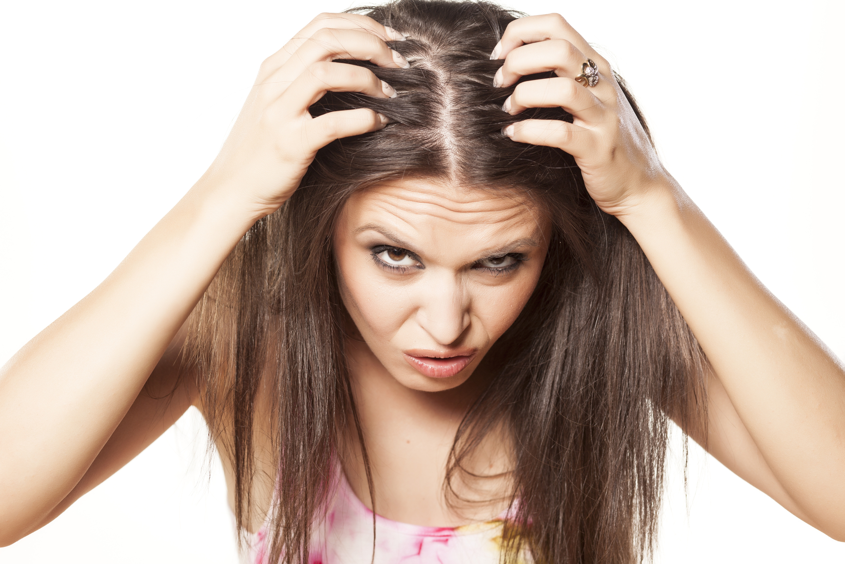 How to Treat Dandruff | Dandruff Causes and Dandruff Cures