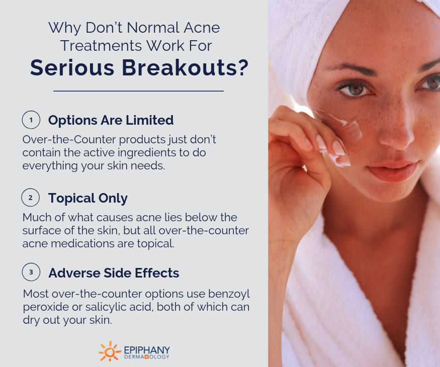 acne treatment plan