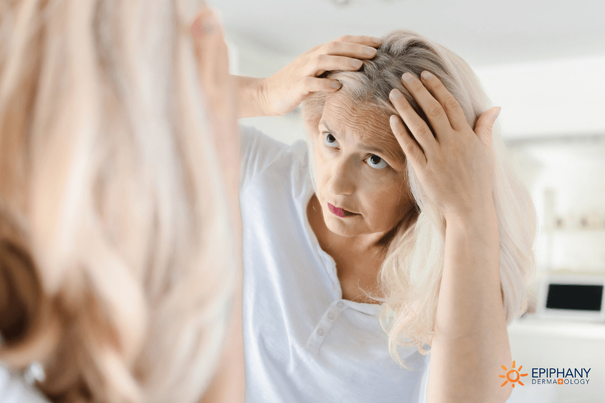 Permanent Female Hair Loss  Living with Hair Loss