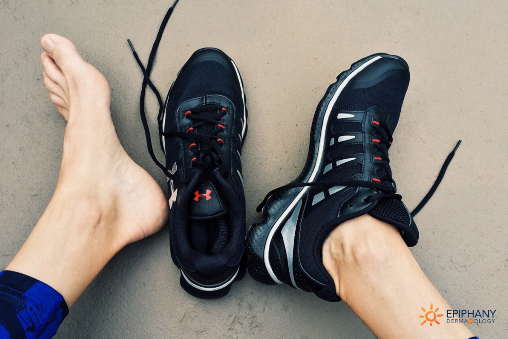 Most Common Questions About Athlete’s Foot Epiphany Dermatology