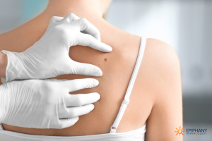 Biopsies