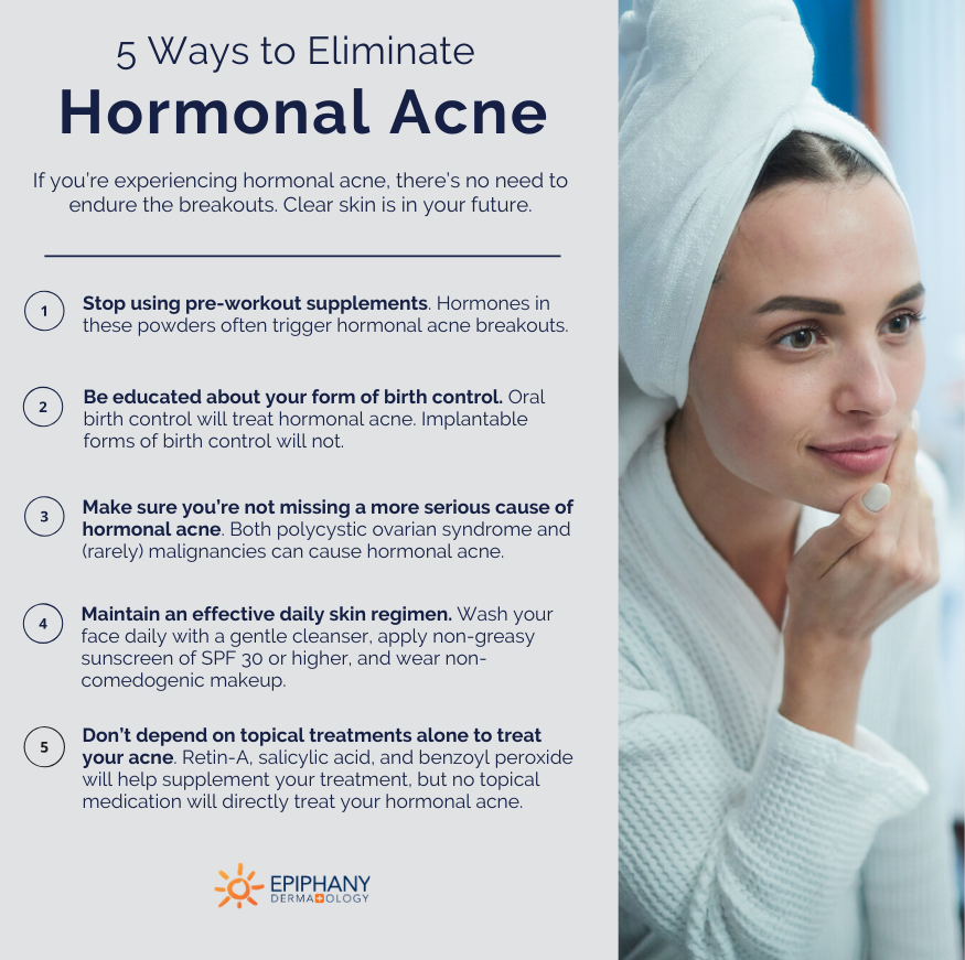 get rid of hormonal acne