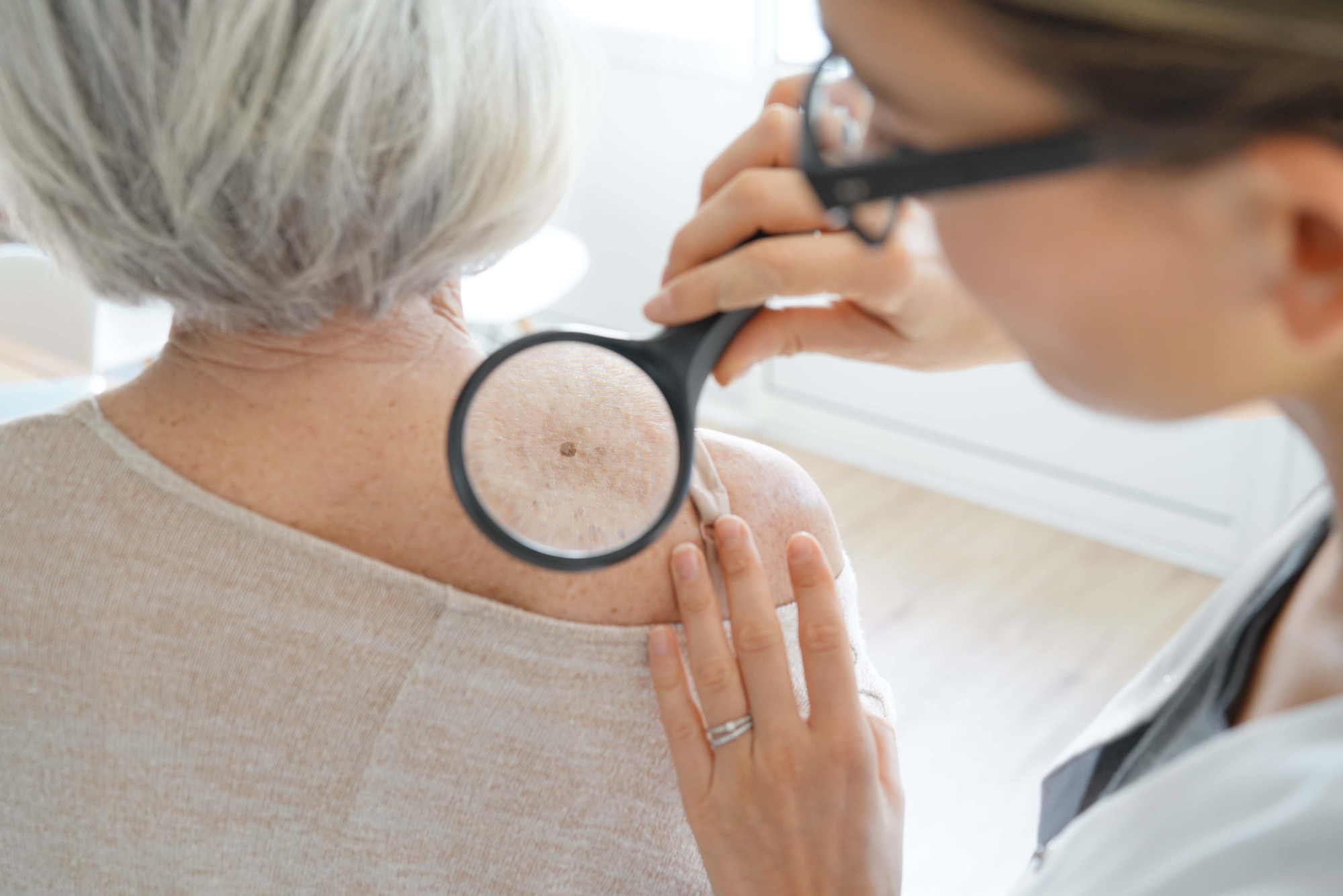 What to expect during yearly skin exam