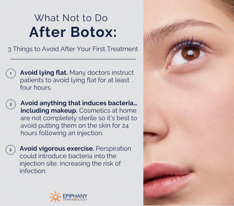 Was nach Botox Epiphany Dermatology nicht zu tun ist HiTech