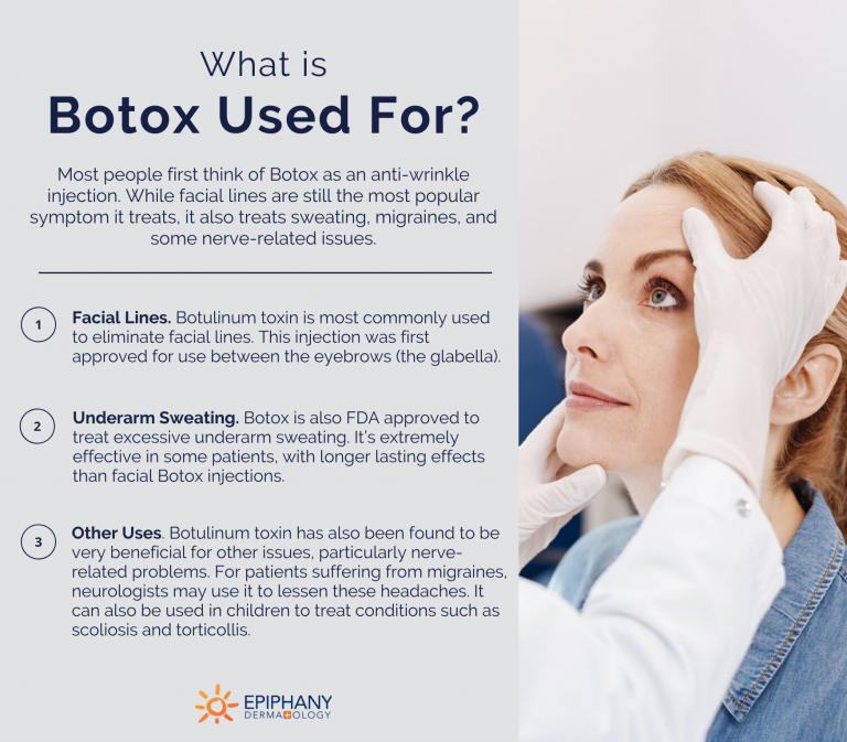 Was nach Botox Epiphany Dermatology nicht zu tun ist HiTech