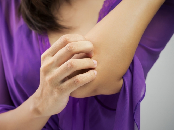 woman scratching her elbow