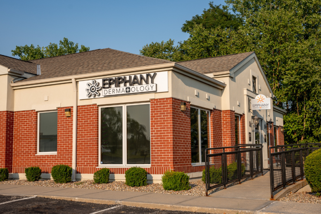 Sun Spots  Epiphany Dermatology